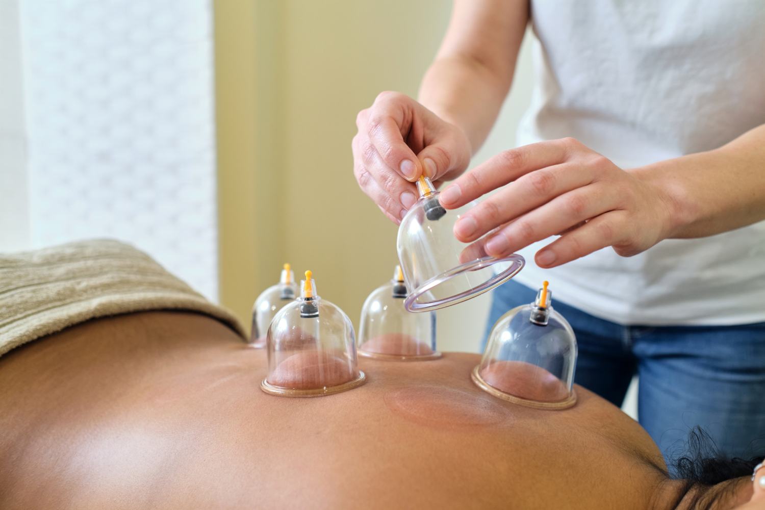 Who Cannot Have Cupping?